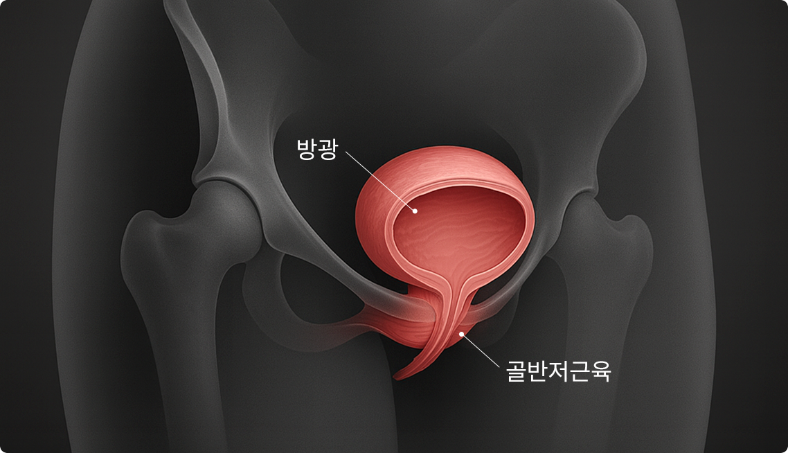 코웨이 HCM-U01 테라솔 U 요실금 치료 의료기기 상세이미지 4